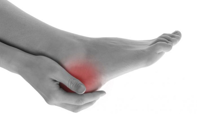 Saznajte uzrok bolova u petama i olakšajte si svaki korak